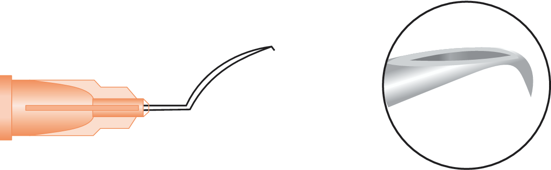 Cystotome Formed